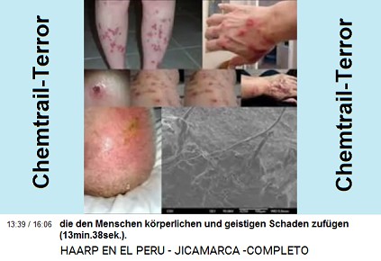 die den Menschen k�rperlichen und
                          geistigen Schaden zuf�gen (13min.38sek.).
                          [Foto: Hausch�den durch Chemtrailmetalle
                          Chemtrails rotten alles aus Durch die
                          Nanoteilchen der Chemtrailmetalle wird das
                          gesamte �kosystem zerst�rt, durch Aluminium,
                          Strontium, Barium und Mangan. Die Erde wird
                          verseucht und in Sonderm�ll verwandelt; die
                          Kleintiere im Boden sterben aus; die Insekten
                          und das Mikroplankton sterben ebenfalls aus;
                          dann sterben die V�gel und die Fische aus;
                          siehe die Veranstaltung der Wissenschaftler in
                          der Provinz Shasta (Shasta County) in
                          Kalifornien im Jahre 2014. Das heisst: Wenn
                          die Chemtrails nicht sofort gestoppt werden,
                          ist in 10 Jahren im Jahre 2025 in denjenigen
                          Regionen, wo Chemtrails verspr�ht werden,
                          nichts mehr am Leben].