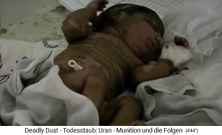 Basra, das Mutter-Kind-Krankenhaus,
                                Baby mit Hautausschlag, Fischmund und
                                Fischaugen