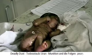 Kind mit
                          NATO-Schaden durch Atomrakete
                          ("Uranmunition") 03