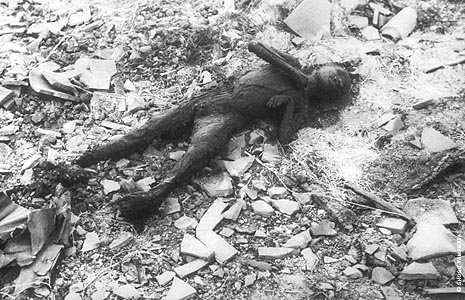 Nagasaki
                          Atombombe: Verbrannter Bub