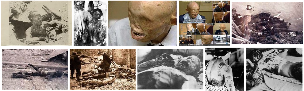 Todesopfer und �berlebende
                  der Atombombenabw�rfe auf Japan 1945 - die Opfer
                  wurden als Testobjekte missbraucht