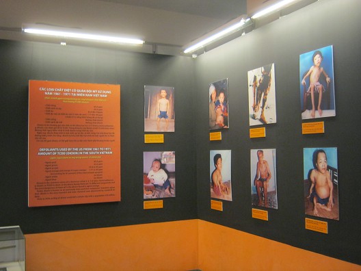 Fotogalerie mit Agent-Orange-Opfern aus Vietnam