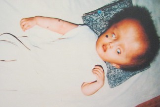 Agent-Orange-Opfer Le Thi Hoang Yen: Le Thi Hoang Yen, geboren 1996, aus der Gemeinde Trung Hieu, Distrikt Vung Liem, Provinz Vinh Long [verformtes Gesicht, verdrehte Augen, viel zu kleine Nase und zu kleiner Mund]