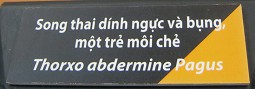 Agent-Orange-Opfer, deformierte F�ten, Text