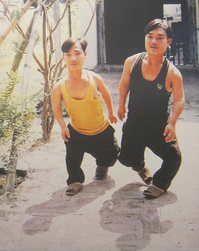 Zwei Agent-Orange-Opfer, die Br�der Nguyen Ngoc Diep und Nguyen Thanh Tung: Die Br�der Nguyen Ngoc Diep und Nguyen Thanh Tung aus der Gemeinde Kim Long, Distrikt Tam Duong, Provinz Vinh Phuc [beide Br�der sind durch verformte und viel zu kurze Beine etwas gehbehindert]