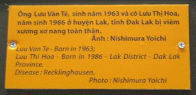 Agent-Orange-Opfer Luu Van Te und Luu Thi Hoa, Text: Agent-Orange-Opfer Luu Van Te (geboren 1963) und Luu Thi Hoa (geboren 1986), Distrikt Lak, Provinz Lak. Krankheit: Recklinghausen [Von-Recklinghausen-Krankheit: ist eine Neurofibromatose, eine Multiorganerkrankung, betroffen sind vor allem die Haut und das Nervensystem - web01] Foto: Nishimura Yoichi