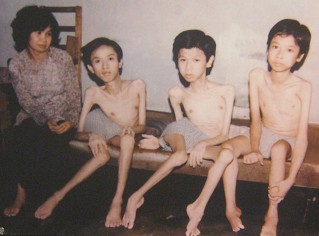 Drei Agent-Orange-Opfer: Mai Giang Vinh, Mai The Quang und Mai The Huy: Nguyen Thi Bich Ngoc vom Distrikt Nr. 11, Saigon (Ho Chi Minh-Stadt), hat 7 Kinder, davon sind drei durch die Aussetzung von Agent Orange / Dioxin gesch�digt: Mai Giang Vinh, Mai The Quang und Mai The Huy [fehlender Muskelaufbau an Armen und Beinen].