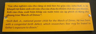 Agent-Orange-Opfer Jonh Ball, Text  Text: "Jonh Ball, Jr., das nationale Plakat-Kind f�r den Groschenmarsch. Er wurde mit einem Geburtsfehler geboren, Forscher meinen, weil der Vater Dioxin ausgesetzt war."