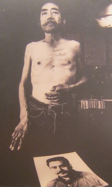 Agent-Orange-Opfer Daniel Salmon: "Das Foto ist von Daniel Salmon, der in der Luftwaffe eine Laufbahn als Elektriker machte. Er machte in Vietnam zwei Rundreisen, wo er bei Rodungen half, um Dschungel in Landepisten zu verwandeln. Sie gebrauchten ein Entlaubungsmittel, und er war dem wiederholt ausgesetzt. Einige Jahre sp�ter entwickelten sich bei ihm Schwindel, Kopfweh, Verdauungsprobleme und Wundstellen. Einige seiner Finger wurden amputiert und dann auch beide Beine. Er starb 1984. Nach dem Verlassen der Luftwaffe konnte er eine lange Zeit keine Versicherungsleistungen oder medizinische Leistungen wegen seiner Invalidit�t erhalten. Sein Todesbericht sagt aus, seine Gesundheitsprobleme k�nnten durch Agent Orange verursacht worden sein."