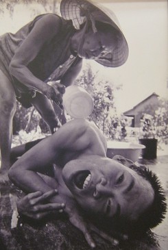 Agent-Orange-Opfer Nguyen Thi Chot: Nguyen Thi Chot ist 62 und die Mutter von zwei Kindern. Hir Ehemann, Nguyen Sat, war w�hrend dem alten Regime ein Soldat, stationiert im Dorf Cam Hoa, Stadt Hoi An. Eines der Kinder ist der 38 Jahre alte Nguyen Vinh. Seine schweren Gesundheitsprobleme begannen mit 2 Jahren, als seine Arme und Beine zu schrumpfen begannen. Tagt�glich findet das Leben von Vinh nur im Bett statt. Die einzige Abwechslung kommt alle drei Tage, wenn ihn seine Mutter ins Bad tr�gt, um ihn zu waschen.