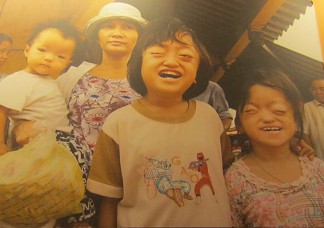 2 Agent-Orange-Opfer: Mutter und Kinder Diese Familie bestreitet ihren Lebensunterhalt, indem sie Produkte verkaufen und Lotterielose im Chinatown in Saigon (Ho Chi Minh City) verkaufen. Beide �ltern Kinder sind Opfer der Agent-Orange-Chemikalien. Die beiden Kinder haben klassische Symptome, verursacht durch Agent Orange [hervorstehende Augen, das Gehirn scheint reduziert und die Sinne eingeschr�nkt] Foto: Muroyama Yasafumi