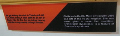 Agent-Orange-Opfer, Text: Dieses M�dchen wurde im Mai 2000 in Saigon (Ho Chi Minh City) geboren und dem Tu-Du-Spital �berlassen. Das Baby hatte nie einen Namen. Die Krankheit ist kraniofaziale Dysostose, ein Merkmal des Crouzon-Syndroms.