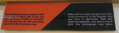 Agent-Orange-Opfer, Text: Namenloses Baby, es wurde aus der Provinz Vinh Long ins Tu-Du-Spital [in Saigon / Ho Chi Minh City] gebracht. Sie wurde im November 1998 mit Hydro-Enzephalitis geboren und starb einen Monat nach diesem Foto.