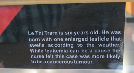 Agent-Orange-Opfer Le Thi Tram, Text: Le Thi Tram ist 6 Jahre alt. Er wurde mit einem vergr[osserten Hoden geboren, der je nach Wetter anschwillt. Leuk[amie kann daf[ur die Ursache sein, aber die Krankenschwester meinte, dass dieser Fall eher was mit einem Krebstumor zu tun hat.
