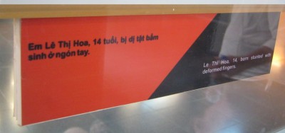 Agent-Orange-Opfer Le Thi Hoa, Text: Agent-Orange-Opfer Le Thi Hoa (14), wurde verk�mmert geboren und hat deformierte Finger