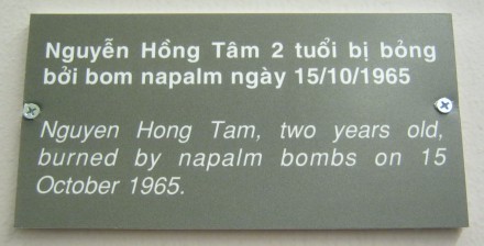 Baby-Napalmopfer Nguyen Hong Tam, 2 Jahre alt, 15. Oktober 1965 - Text