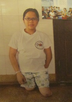 Agent-Orange-Opfer Tran Thi Hoan ohne Beine und die linke Hand fehlt