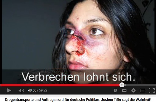 Eine Frau mit einem gen�hten
                            Nasenbeinbruch - die muslimischen und die
                            linken Schl�ger werden von der K�lner Justiz
                            nie bestraft