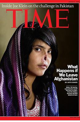 Afghanin ohne Nase: Taliban schnitten einer
                Afghanin die Nase ab, weil sie sich von ihrer Familie
                loslösen wollte [2]