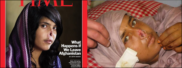 Afghaninnen ohne Nase, Aisha aus Kandahar
                      (braun-schwarze Augen) und Nazia aus Uruzgan
                      (grüne Augen) [5]