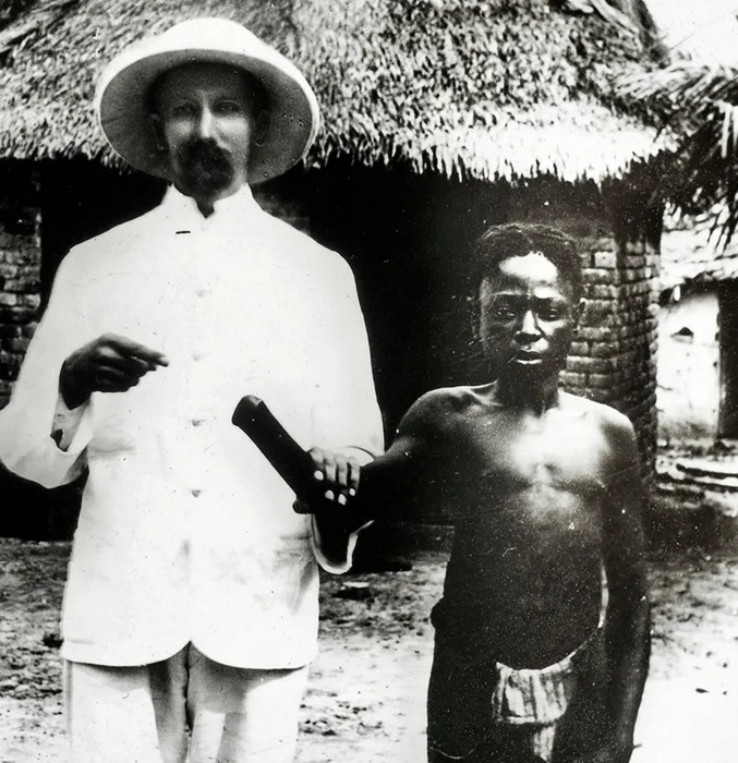 Belgium in Congo: A Jesus
fantasy missionary shows an African
Congo child without right hand which
was amputated Belgium in Congo:
A Jesus fantasy missionary shows an
African Congo child without right hand
which was amputated