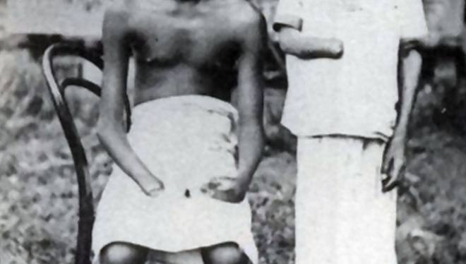 Two children in the Belgium
"Christian" Congo colony under the Jesus
fantasy "Christian" king Leopold II: the
children are without right hand - zoom Two
children in the Belgium "Christian"
Congo colony under the Jesus fantasy
"Christian" king Leopold II: the
children are without right hand - zoom