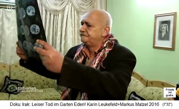 Kinderarzt Jabbar Said Falyh im Irak pr�ft R�ntgenbilder