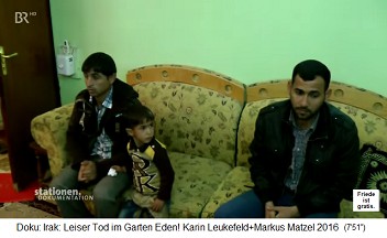 Irak, ein Kind Muhammad mit Geburtsschaden mit einer aussenliegenden Blase, nun hat sich eine Fistel gebildet 01