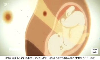 Trickfilm: Das Uran zerst�rt auch die F�ten und Ungeborene bei Schwangeren