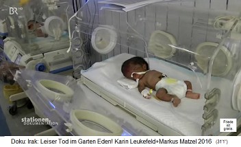 Basra (Irak), das Kinderkrankenhaut mit Fr�hgeburten mit Missbildungen