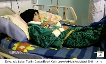 Basra (Irak): Im neuen Kinderkrankenhaus f�r Krebskinder schaut eine Jugendliche fern